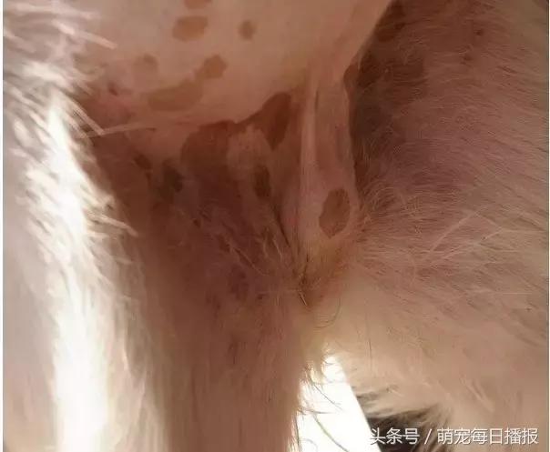 小儿疝气最新治疗方法
